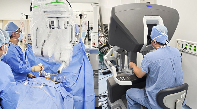 충남대병원 정유영 교수, 소아 종격동 종양 단일공 로봇수술 성공