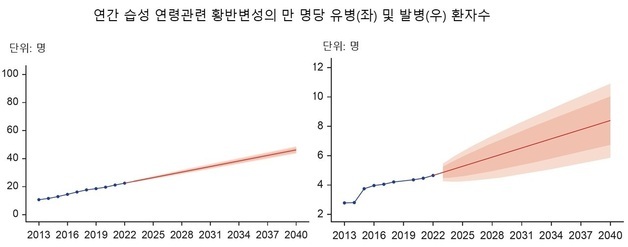 "습성 연령관련 황반변성 유병률, 2040년엔 현 수준 2배"
