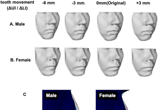 성인 치아 교정 만족도, 남성이 여성보다 높아…50대서 차이 뚜렷