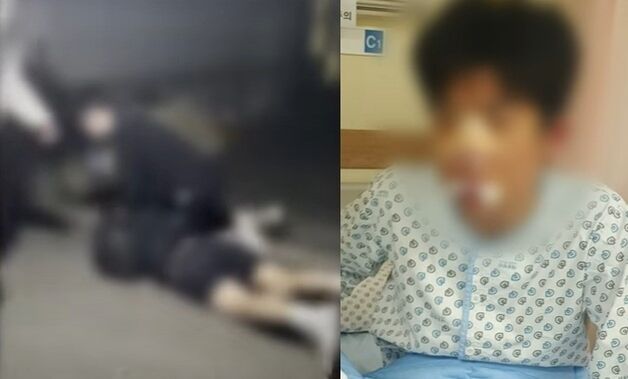 "내 여친과 친하게 지내?"…동급생 코뼈 부러지도록 집단폭행한 고교생들