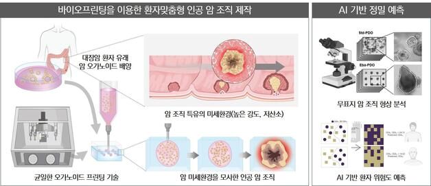 "암조직 모양으로 AI가 예후 예측" 암 성장 환경 모사 기술 개발