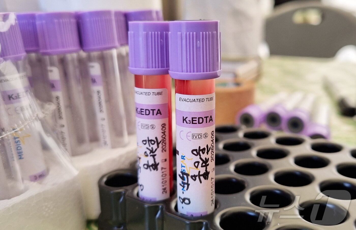 본문 이미지 - 4·3 희생자 유족 홍창흥 씨(70·서귀포시 토평동)의 혈액이 담긴 혈액용기들.2025.4.3./뉴스1