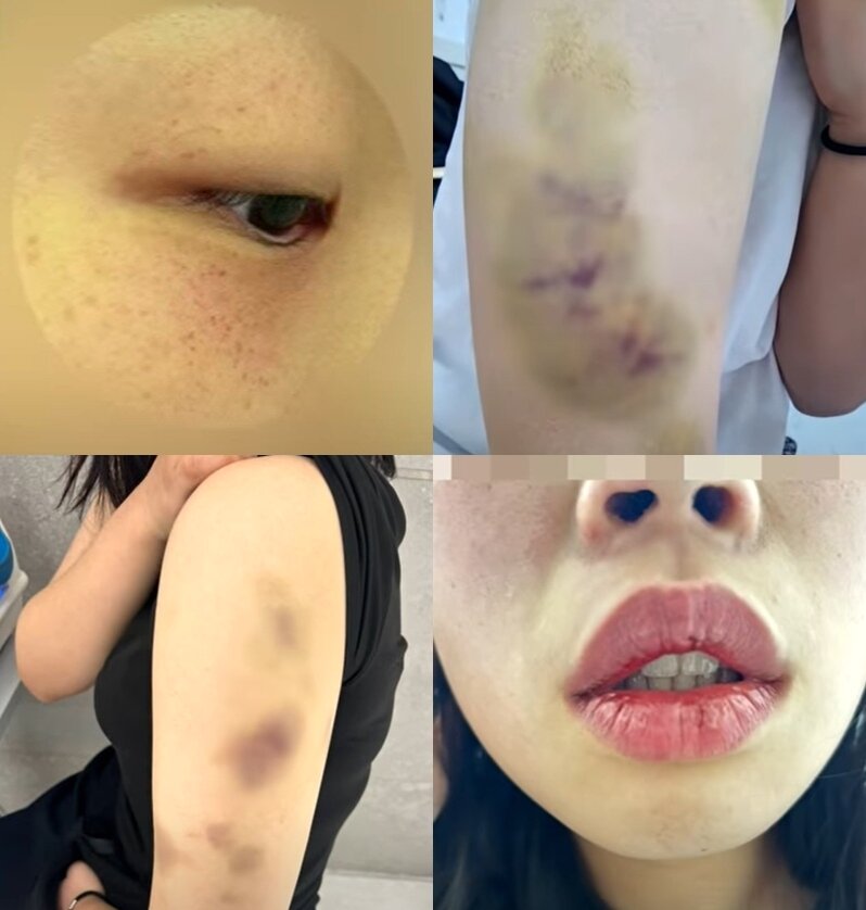 본문 이미지 - (JTBC '사건반장')