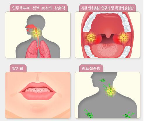 올해 성홍열 3809명 발생…청주·제주 소아시설 확산 주의(종합)