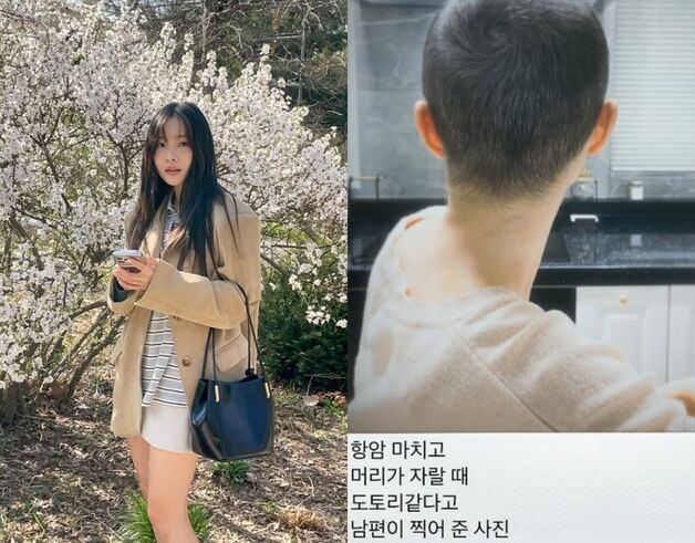 '박성광 아내' 이솔이, 암투병 회상 "앙상한 몸…친구 펑펑 울어"