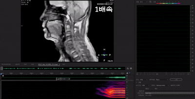 본문 이미지 - 훈민정음해례본에 기술된 상형의 실체를 MRI 기계를 통해 움직이는 영상으로 구현한 모습.