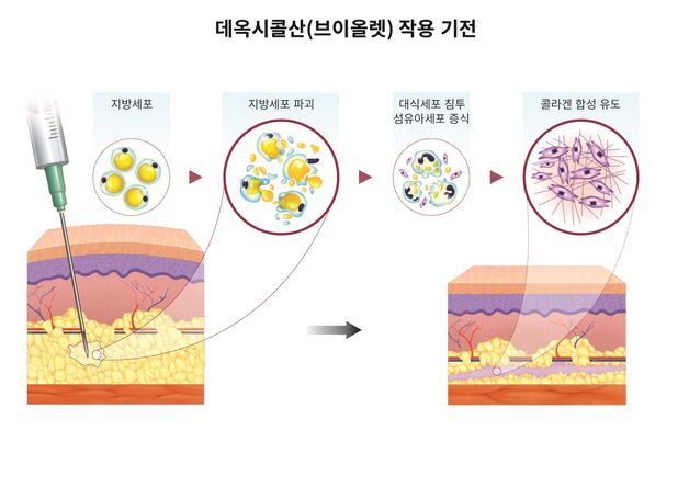 대웅제약 브이올렛 'DCA', 팔뚝살 7.49㎜ 줄여…美 SCIE 저널 발표