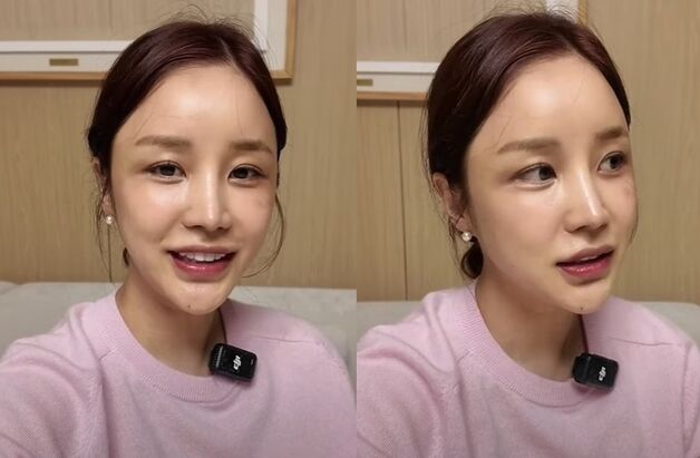 '피부과 시술받다 얼굴 화상' 윤진이 상처 공개…4년 지났는데도 뚜렷
