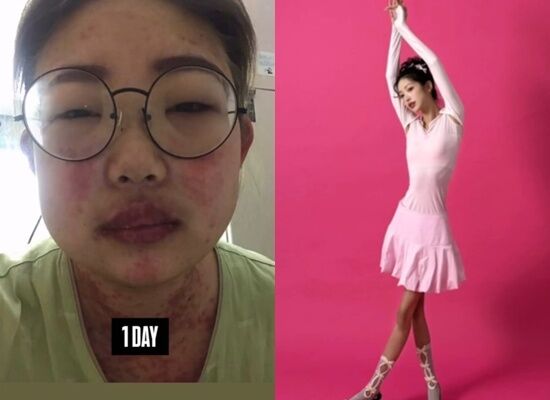 최준희 "나락서 50kg 감량 후 41kg로…나를 사랑하게 돼" 비교 사진 공개 [N샷]