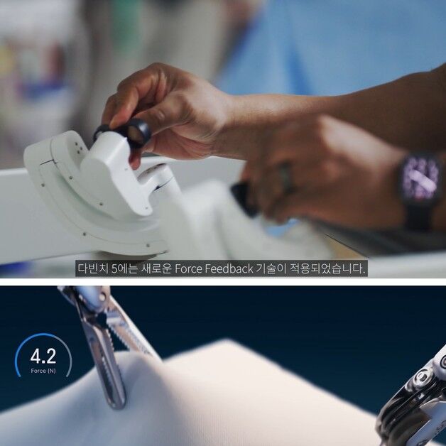 인튜이티브, 다빈치5 '포스 피드백' 효용성 입증 논문 국제학술지 게재