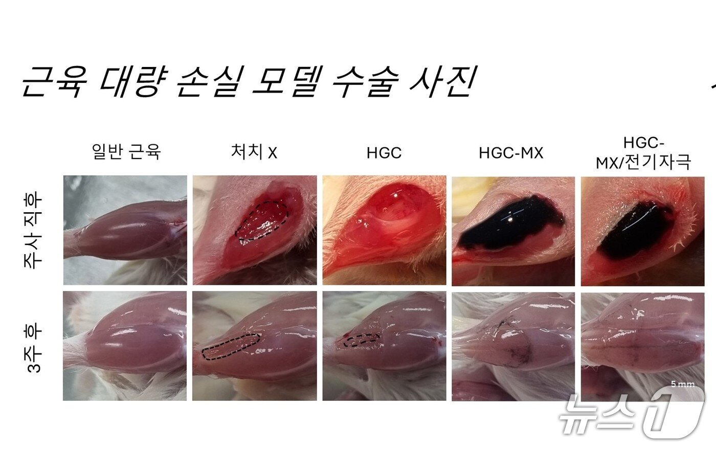 본문 이미지 - 근육 대량 손실 모델 수술 사진(지스트 제공, 재판매 및 DB금지) 