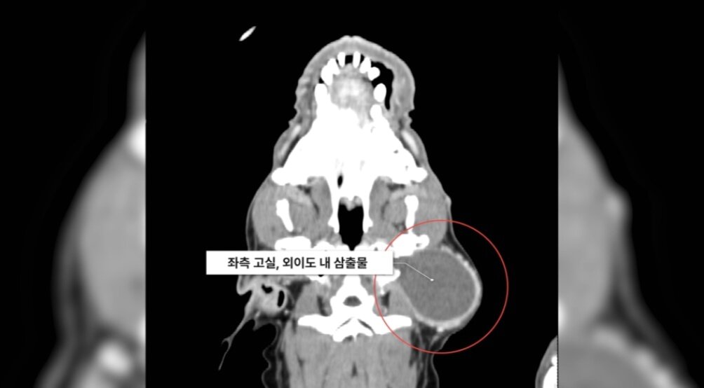 본문 이미지 - 민트는 CT 검사 결과 염증이 중이를 넘어 뇌로 확산되기 직전이었다(SD동물의료센터 제공). ⓒ 뉴스1