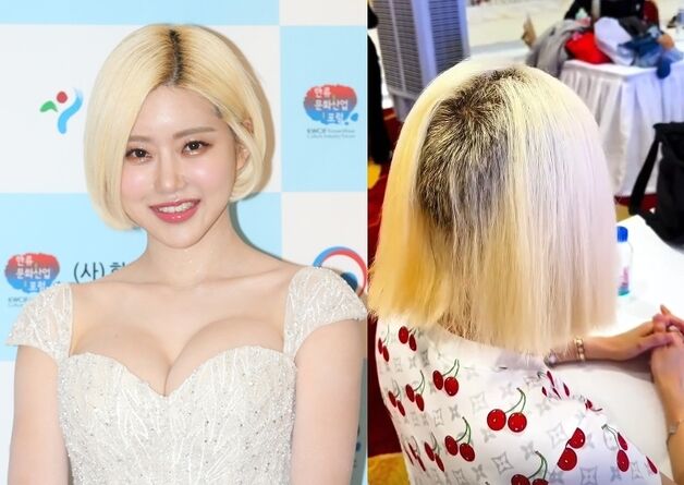 "500만원 줄게, 글 내려" 탈색 잘못돼 머리카락 녹아내린 DJ 소다, 협박당했다