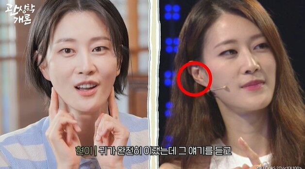 이현이 "'칼귀 돈 줄줄 샌다'고…필러 맞아 귓불 채웠더니 효과"