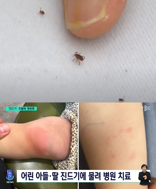 본문 이미지 - (SBS 갈무리)