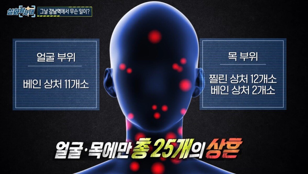 본문 이미지 - &#40;MBC &#39;실화탐사대&#39; 갈무리&#41;