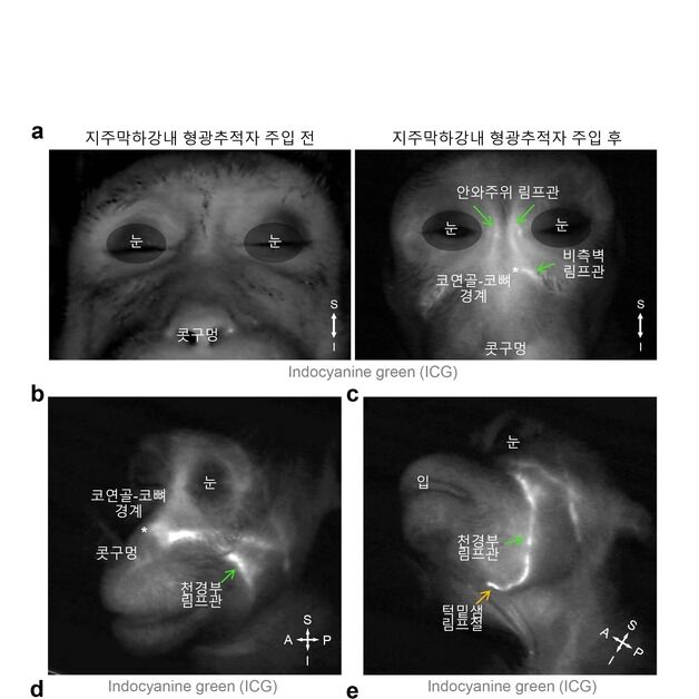 IBS 뇌 속 노폐물, 간편 배출 방법 찾았다…"치매 연구 이정표될 것"