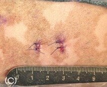 본문 이미지 - 수술 후 1㎝ 미만의 작은 절개창 2개(본동물의료센터 제공) ⓒ 뉴스1