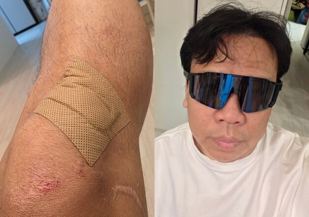 "미끄러져 핸들 놓쳤다"…오지헌, 빗길 낙차사고에 부상 '아찔'