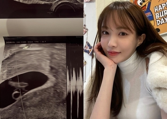 '임신' 서민재 "아이 친부, 연락 없어…책임 외면"
