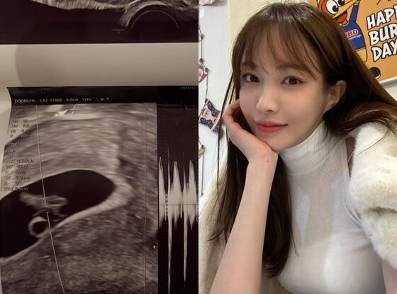 '임신' 서민재 "아이 친부, 여전히 연락 없어…책임·도리 외면"