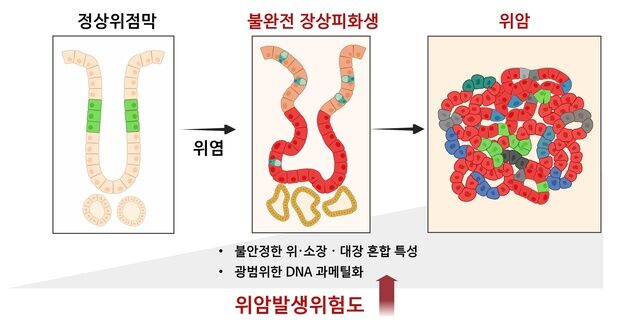 제주의대, 위암 전단계 최초 입증…"장상피화생 세심한 관찰 필요"