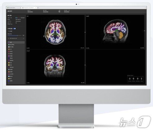 '의료 AI 기업' 뉴로핏, 상장 첫날 '따블' 터치[핫종목]