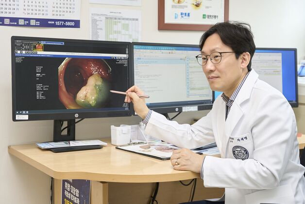 대장암 조기 발견, '정확한 내시경 검사'가 살린다