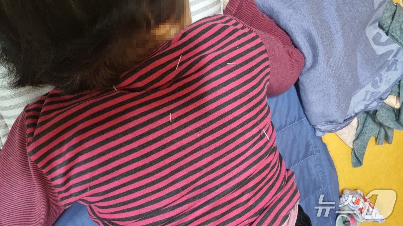 본문 이미지 - A 씨가 침을 놓고 있는 장면.(제주도자치경찰단 제공. 재판매 및 DB 금지)/뉴스1  