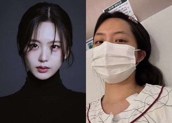 '걸그룹 출신 배우' 류지원, 백혈병 투병 중 "깊은 수렁 빠져…머리카락도 없어"