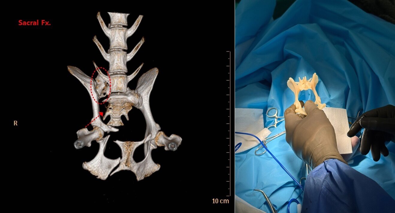 본문 이미지 - 교통사고를 당한 반려견의 CT 검사 사진과 3D 프린팅으로 제작한 해당 반려견의 천추 모형(예은동물의료센터 제공) ⓒ 뉴스1