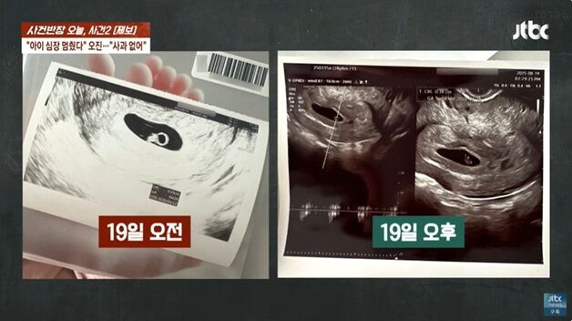 '태아 심장 멈췄다' 오진한 병원장 "내가 틀려도 좋은 거잖아" 황당 해명
