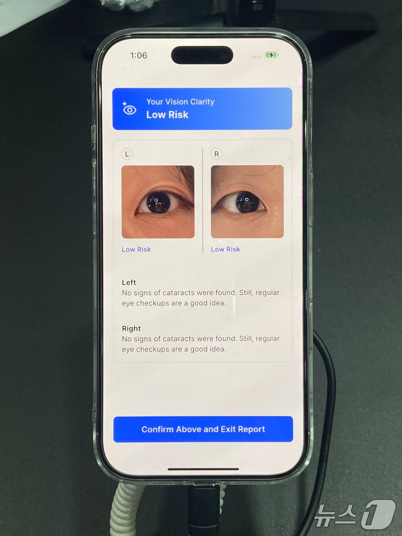 본문 이미지 - 카카오임팩트의 &#39;테크포임팩트 LAB&#39; 프로젝트 중 랩에스디&#40;LabSD&#41;와 협업한 AI 기반 백내장 진단 애플리케이션&#40;앱&#41; &#39;카타스캔&#39;&#40;CataScan&#41;. 기자가 직접 응답한 설문 결과와 촬영한 눈 사진을 기반으로 백내장 위험도를 진단했다. 2025.08.25. ⓒ 뉴스1 신은빈 기자