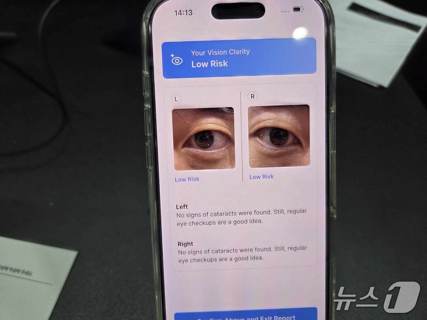 본문 이미지 - 25일 서울 강남구 코엑스에서 열린 '제2회 사회적 가치 페스타' 내 카카오임팩트 부스에서 직접 체험한 CataScan의 백내장 검사 앱.  ⓒ News1 박기범 기자