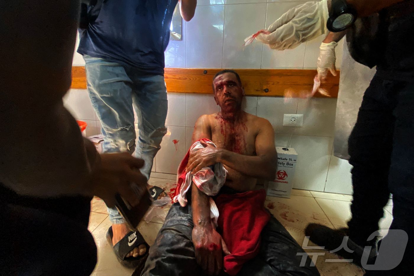 (칸유니스 AFP=뉴스1) 권영미 기자 = 팔레스타인 사진기자 하템 오마르가 25일(현지시간) 가자지구 남부 칸 유니스에 위치한 나세르 병원에서 이스라엘의 공습으로 부상을 입은 뒤 …