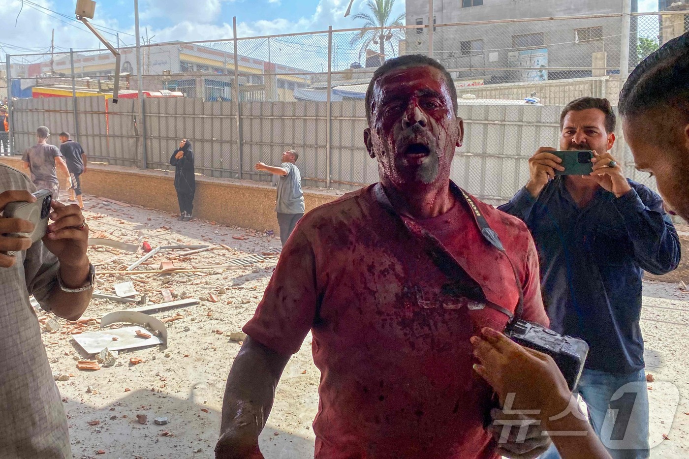 (칸유니스 AFP=뉴스1) 김경민 기자 = 팔레스타인 사진기자 하템 오마르가 25일(현지시간) 가자지구 남부 칸유니스에 있는 나세르 병원에 대한 이스라엘의 공습으로 부상당한 모습. …