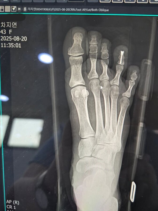 본문 이미지 - 차지연 인스타그램