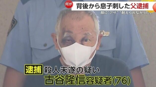 "더 이상 맞기 싫었다" 얼굴 피멍 든 70대父, 장남 흉기로 찌른 후 자수
