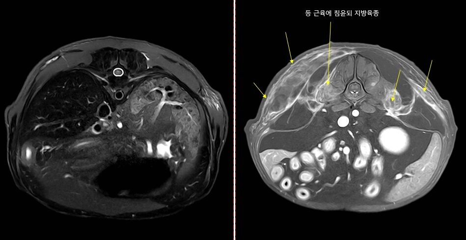 본문 이미지 - 디스크 질환으로 의심됐던 환견의 body MRI 사진.  body MRI 촬영은 국내 동물병원에서는 극히 드문 촬영으로 내장 장기의 움직임을 방지하기 위한 고난도 촬영 기술이 필요하다&#40;동물병원 제공&#41;. ⓒ 뉴스1
