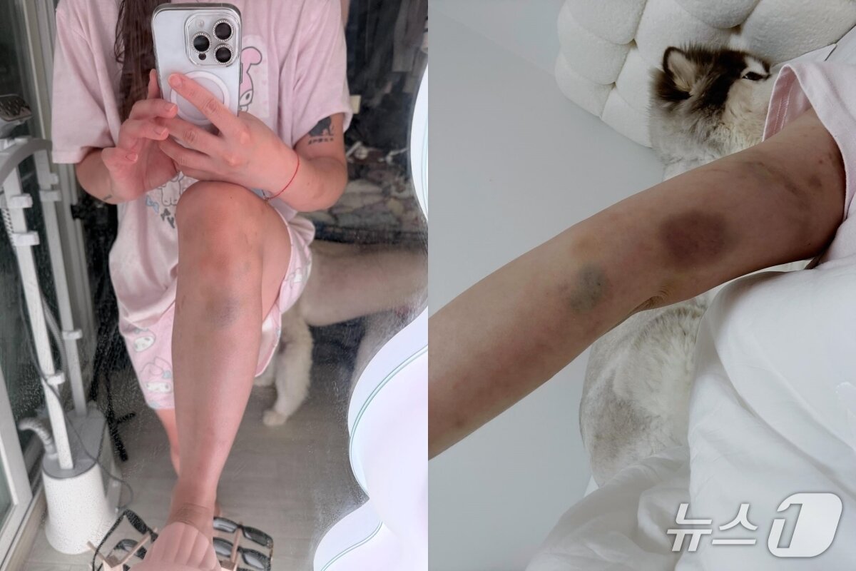 본문 이미지 - &#40;SNS 갈무리&#41;