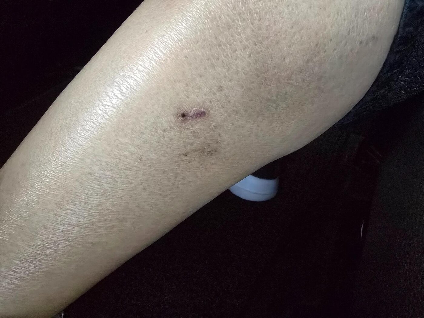 본문 이미지 - &#40;보배드림 갈무리&#41;