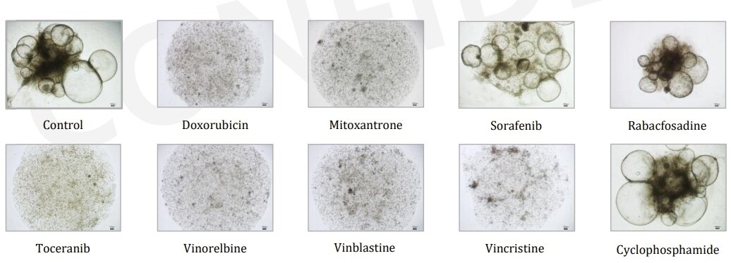 본문 이미지 - 다양한 항암제에 대한 오가노이드 감수성 검사 예시&#40;포도테라퓨틱스 제공&#41; ⓒ 뉴스1