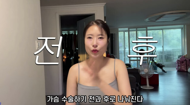 이세영 "내 삶 가슴수술 전후로 나뉘어…A에서 D컵, 만족도 2000%"