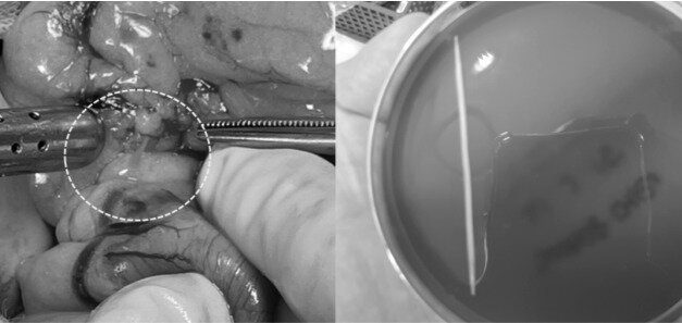 본문 이미지 - 응급 개복 수술을 통해 제거한 이쑤시개&#40;본동물의료센터 제공&#41; ⓒ 뉴스1