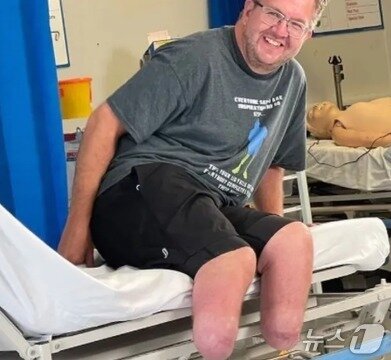 본문 이미지 - 다리 절단 후의 모습 - 인스타그램 갈무리