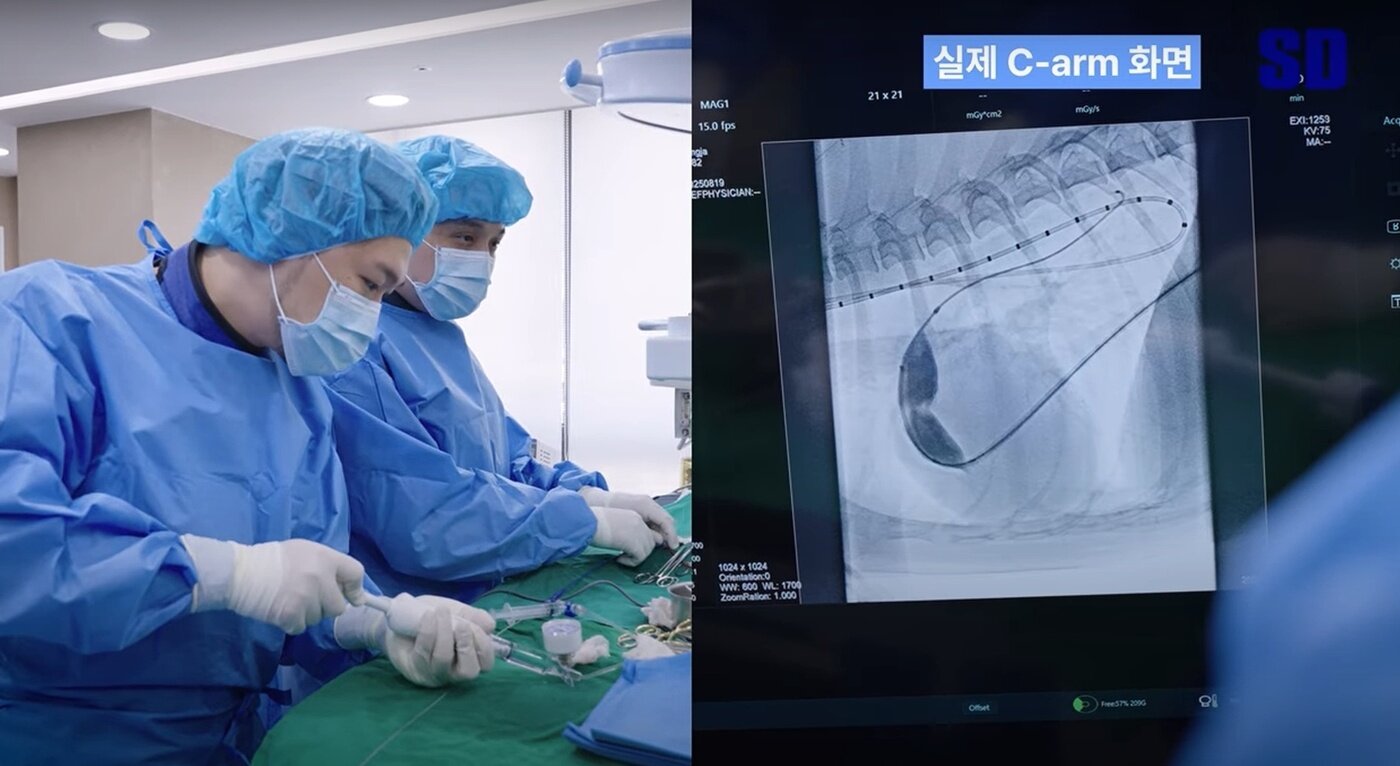 본문 이미지 - 김규창 외과 원장(왼쪽)과 장주필 영상의학과 과장이 폐동맥 협착증 인터벤션 시술을 진행하고 있다(SD동물의료센터 유튜브 갈무리). ⓒ 뉴스1