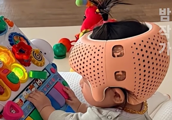 손담비 김지혜 아기도 300만원 '두상 헬멧'…"학대일 뿐" vs "되려 감사"