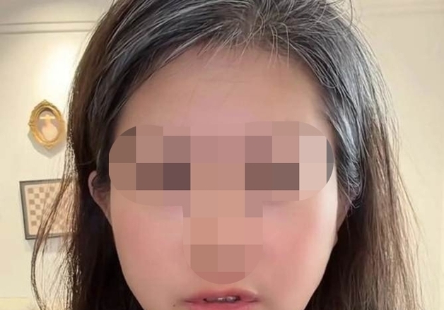 "남편 차에서 '내 절친과 낙태' 서류 발견"…충격에 머리 하얗게 센 여성