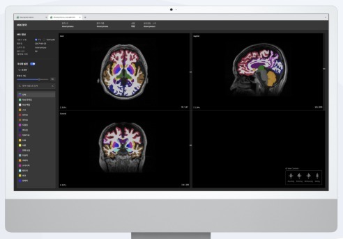 뉴로핏, 한국에자이와 '뉴로핏 아쿠아' 치매 진단 서비스 MOU 체결