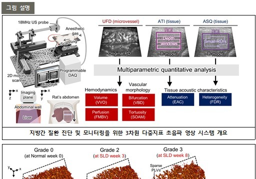 포스텍 연구팀, '3차원 초고속 혈관 초음파'로 지방간 정밀 판독